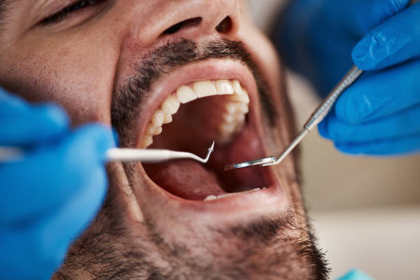Dental Inlays and Onlays in Highland, MD